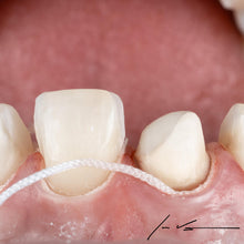 Curion_Dental_ProPak™ Plain Retraction Cord