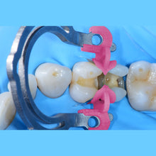 Quickmat Prime by Polydentia sectional matrix system with integrated wedges for Class II restorations. Curion Dental