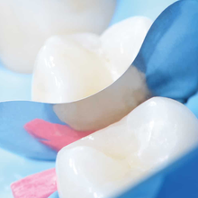 QuickmatFLEX™ titanium sectional matrices by Polydentia for Class II restorations.