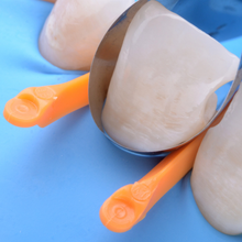 Polydentia myWedge. Hollow V-shaped interdental wedges for Class II restorations.