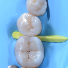 Mywedge Matrix Systems