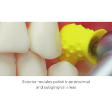 Short Screw-In Prophy Cups - Turbine Blade | Curion Dental