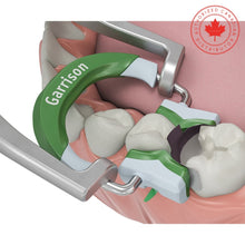 Composi-Tight® 3D Fusion™ Ring | Curion Dental