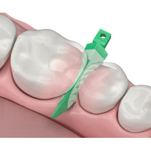 Strata-G™ Wedges - Soft-Faced, Anatomically Shaped Interproximal Wedges, Green Wedge Contour