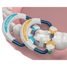 Système de matrice sectionnelle Strata-G™