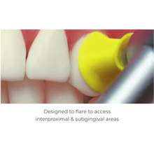 Coupes Prophy courtes RA - tige en métal, lame de turbine | Curion Dental