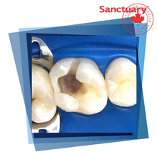 Compresses dentaires Sanctuary™ Non-Latex, Clinical Image