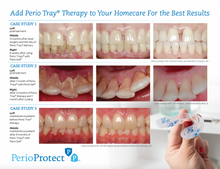 Perio Protect® – Patient Education Marketing Pack Oral Care & Comfort