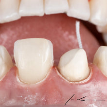 Curion_Dental_ProPak™ : fil de rétraction simple