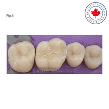 LM-Arte™ Fissura | Curion Dental