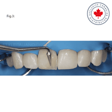 LM-Arte™ Fissura | Curion Dental