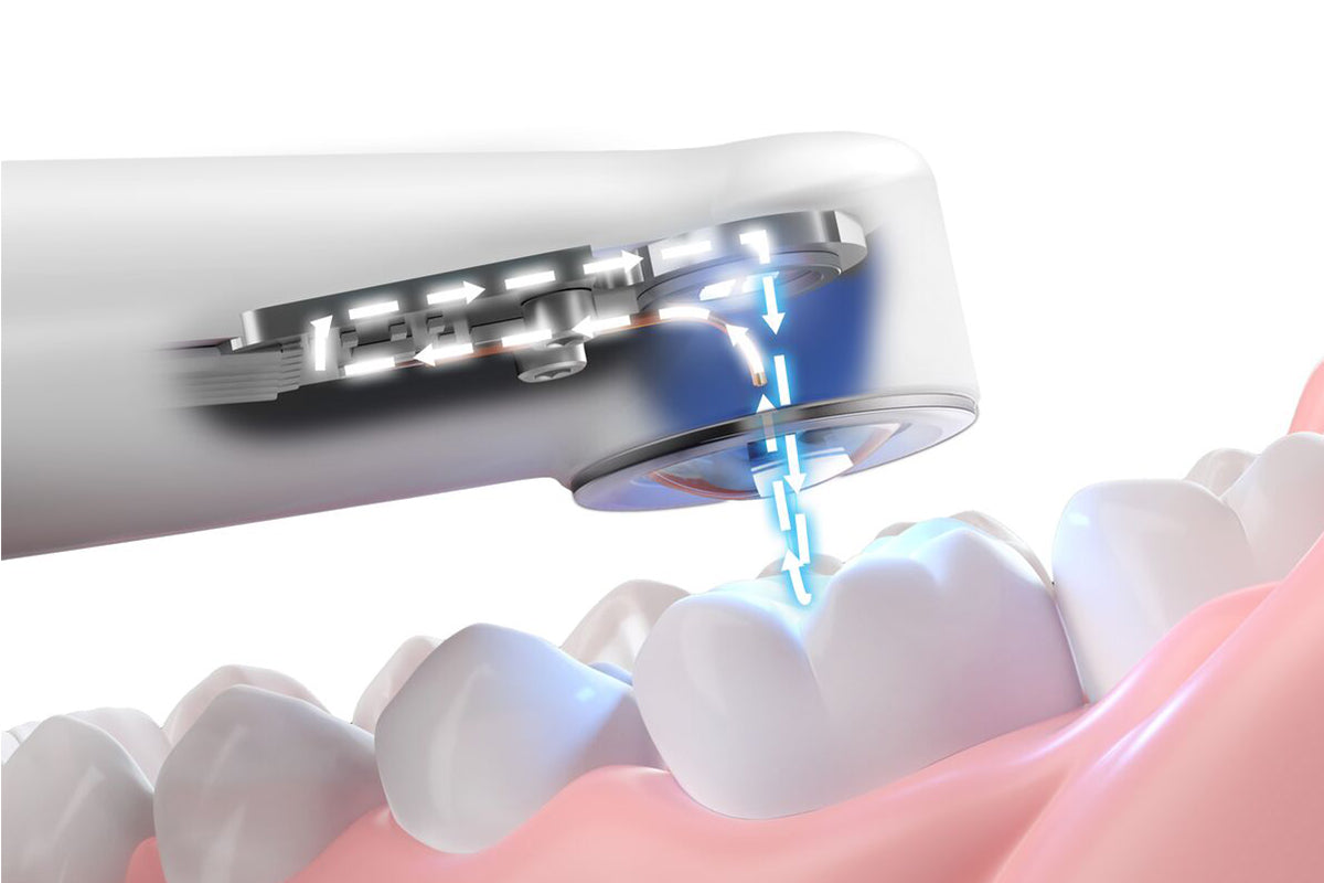 Maîtriser la photopolymérisation : Garantir des restaurations prévisibles et durables