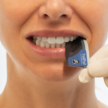 Bandes TrollFoil™ ultrafines pour un marquage précis du contact occlusal sur des dents humides ou sèches, Image clinique.