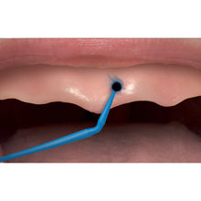 Hydent® pour l'indication du point haut des prothèses dentaires | Curion Dental